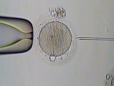 阴超具体怎么检查卵泡发育情况